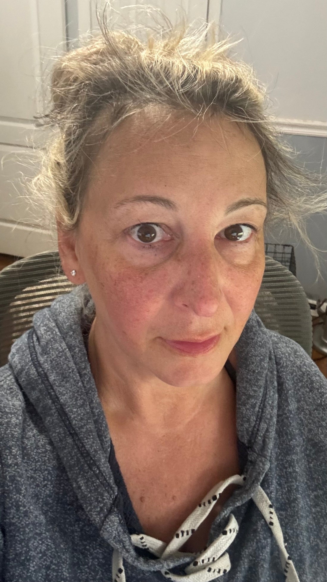 I believe in showing real skin, real texture, and real confidence. That’s why I’m sharing this unfiltered photo alongside the products I personally use and trust every day
